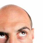 Випадіння волосся на голові у чоловіків: гени чи спосіб життя?