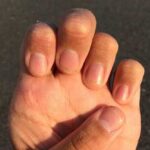 “Не пропустіть їх”: Проблем з нігтями, які є симптомами захворювань