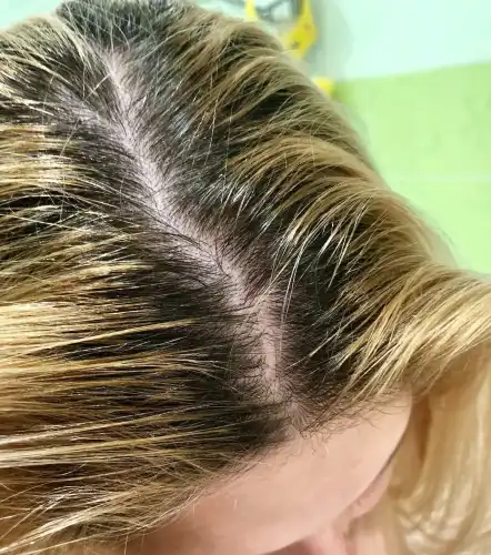 Двійко шкідливих та трійко дієвих настанов для власниць жирного волосся